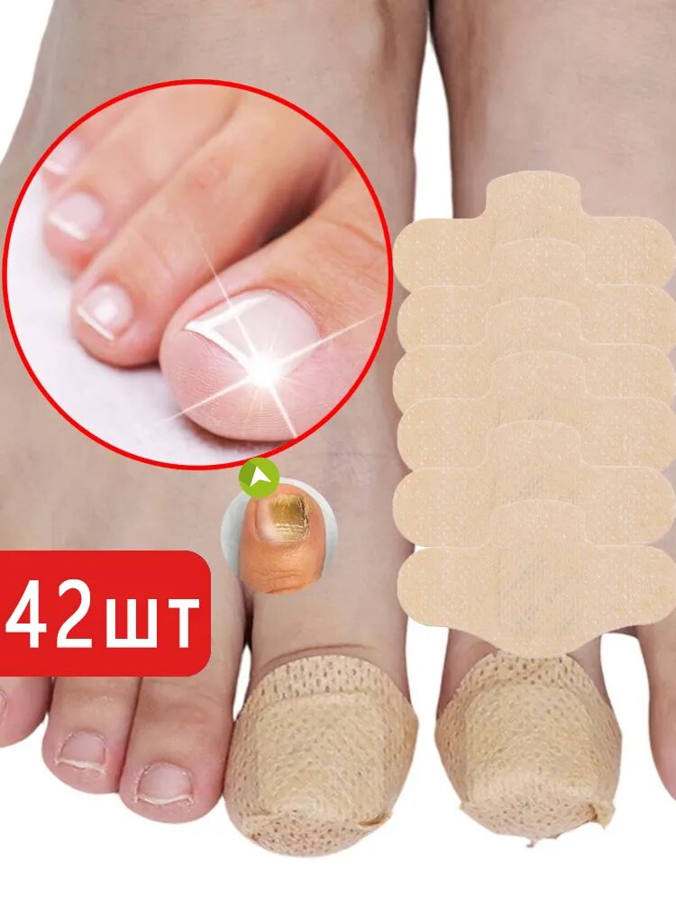 Пластырь для лечения ногтей для борьбы с грибком, коррекции ногтей, 42 штук