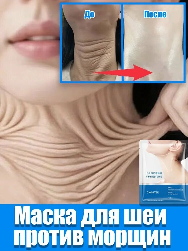 Патчи