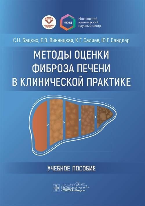 Методы оценки фиброза печени в клинической практике : учебное пособие / С. Н. Бацких, Е. В. Винницка