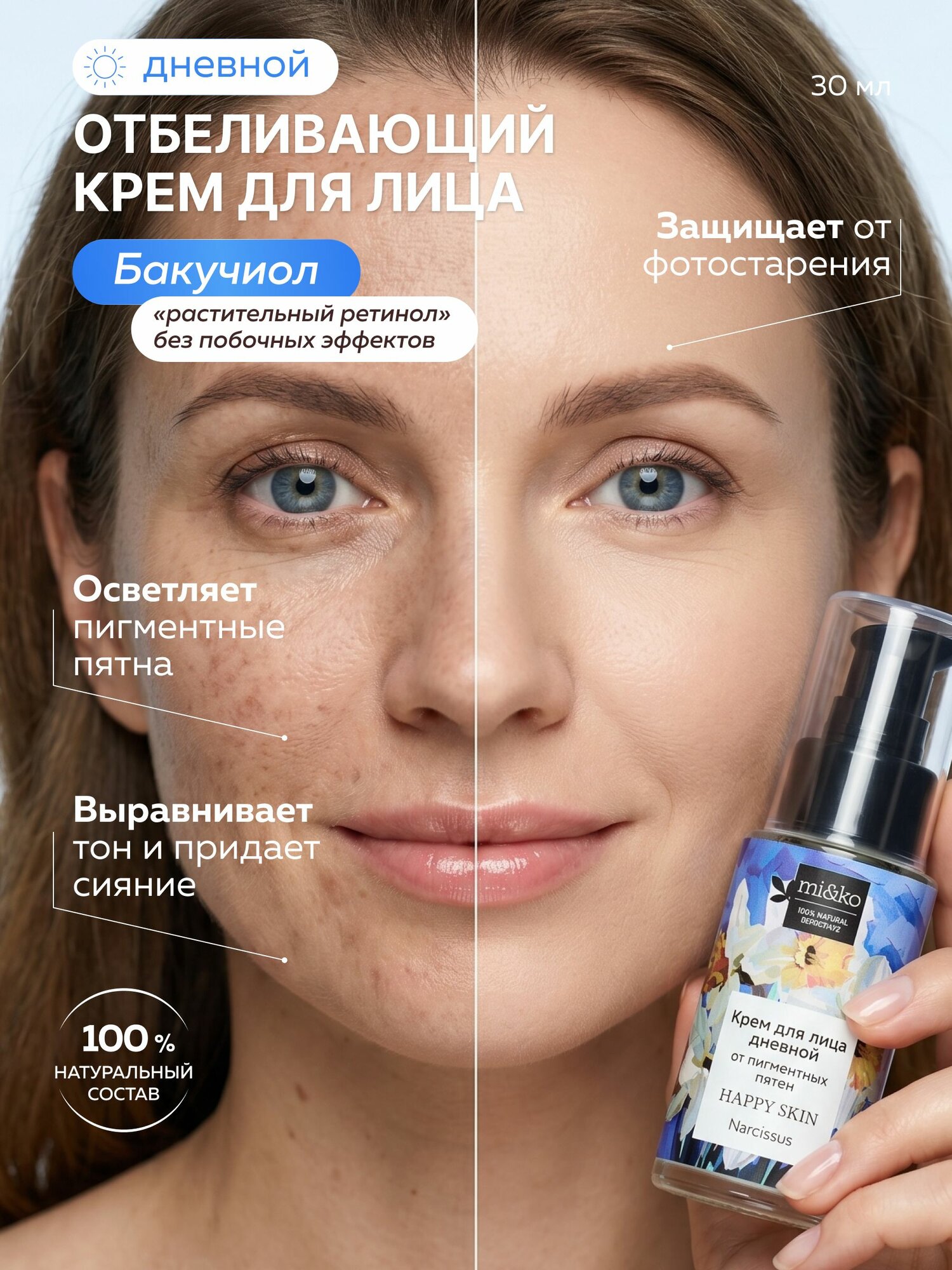 Отбеливающий крем для лица от пигментных пятен от веснушек от постакне 100% натуральный
