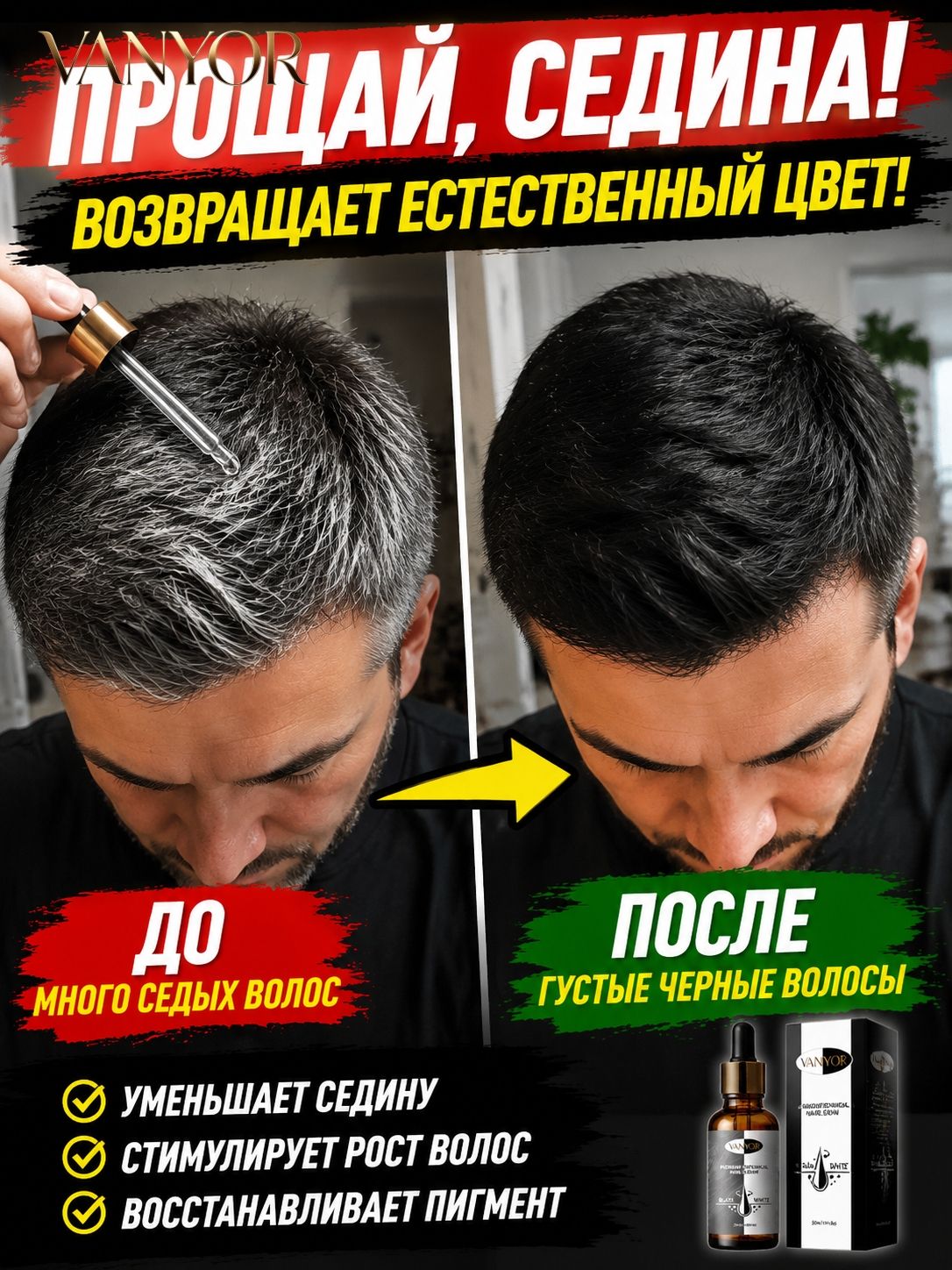 VANYOR-B Средство для ухода за бородой, сыворотка, 300 мл-Луанлуо