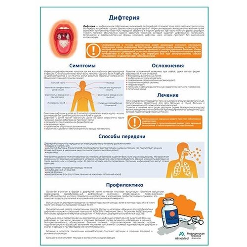 Дифтерия медицинский плакат, глянцевая фотобумага от 200 г/кв. м, размер A1+