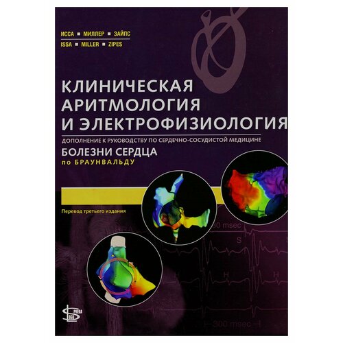 Клиническая аритмология и электрофизиология: дополнение к руководству по сердечно-сосудистой медицине. Исса З. Ф, Миллер Д. Ж, Зайпс Д. П. Логосфера