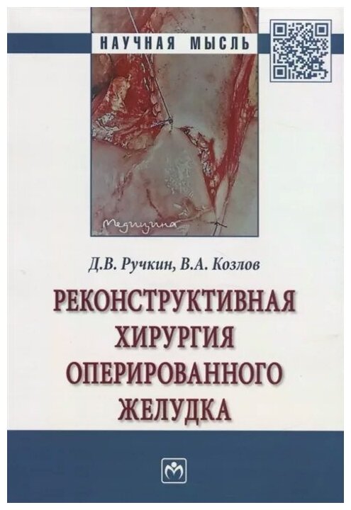 Реконструктивная хирургия оперированного желудка - фото №1