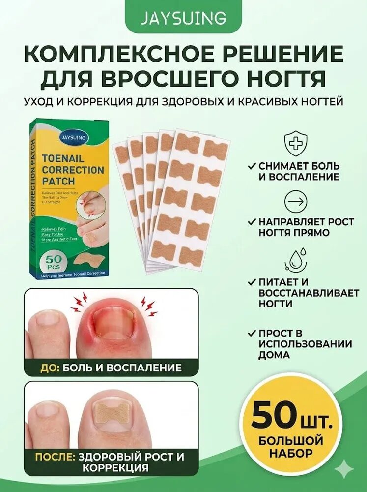 Пластырь-корректор от вросшего ногтя 50шт, корректор при врастании ногтевой пластины