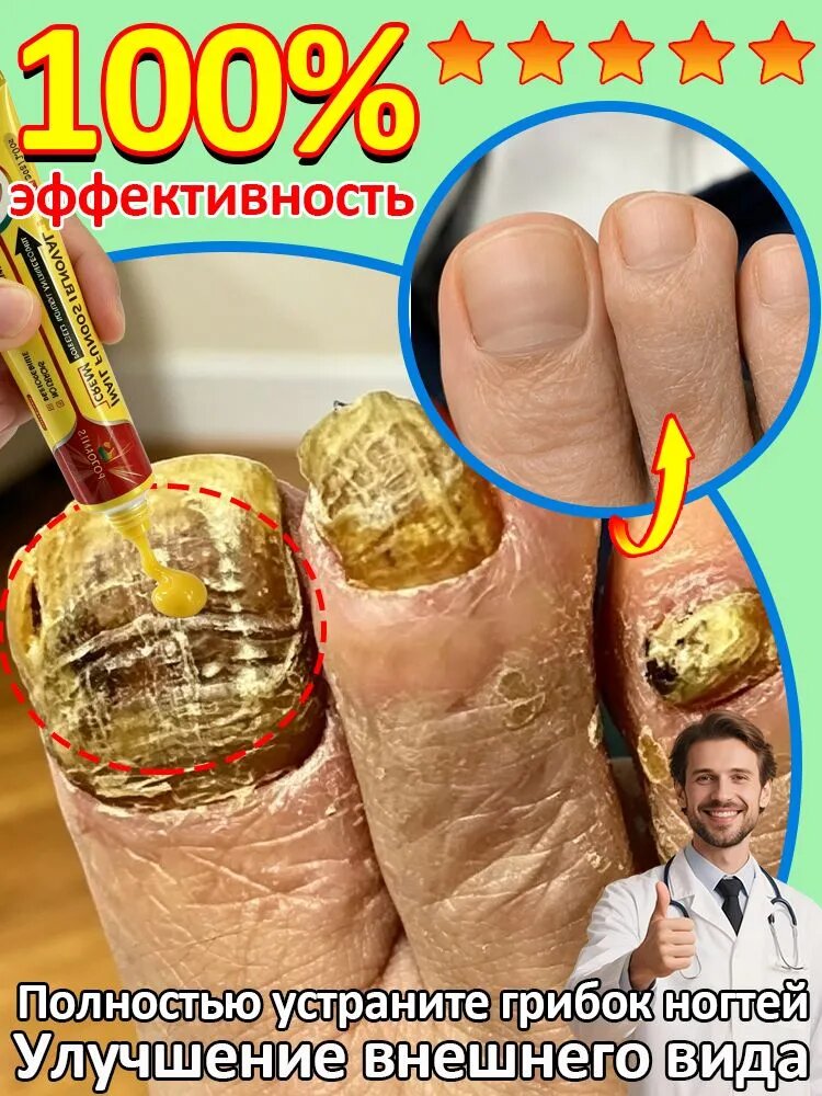 Крем для ухода за ногтями ног, восстановление ногтевой пластины, уход за поврежденными ногтями, укрепление и защита, 30 мл