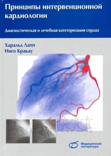 Лапп, кракау: принципы интервенционной кардиологии. диагностическая и лечебная катетеризация сердца