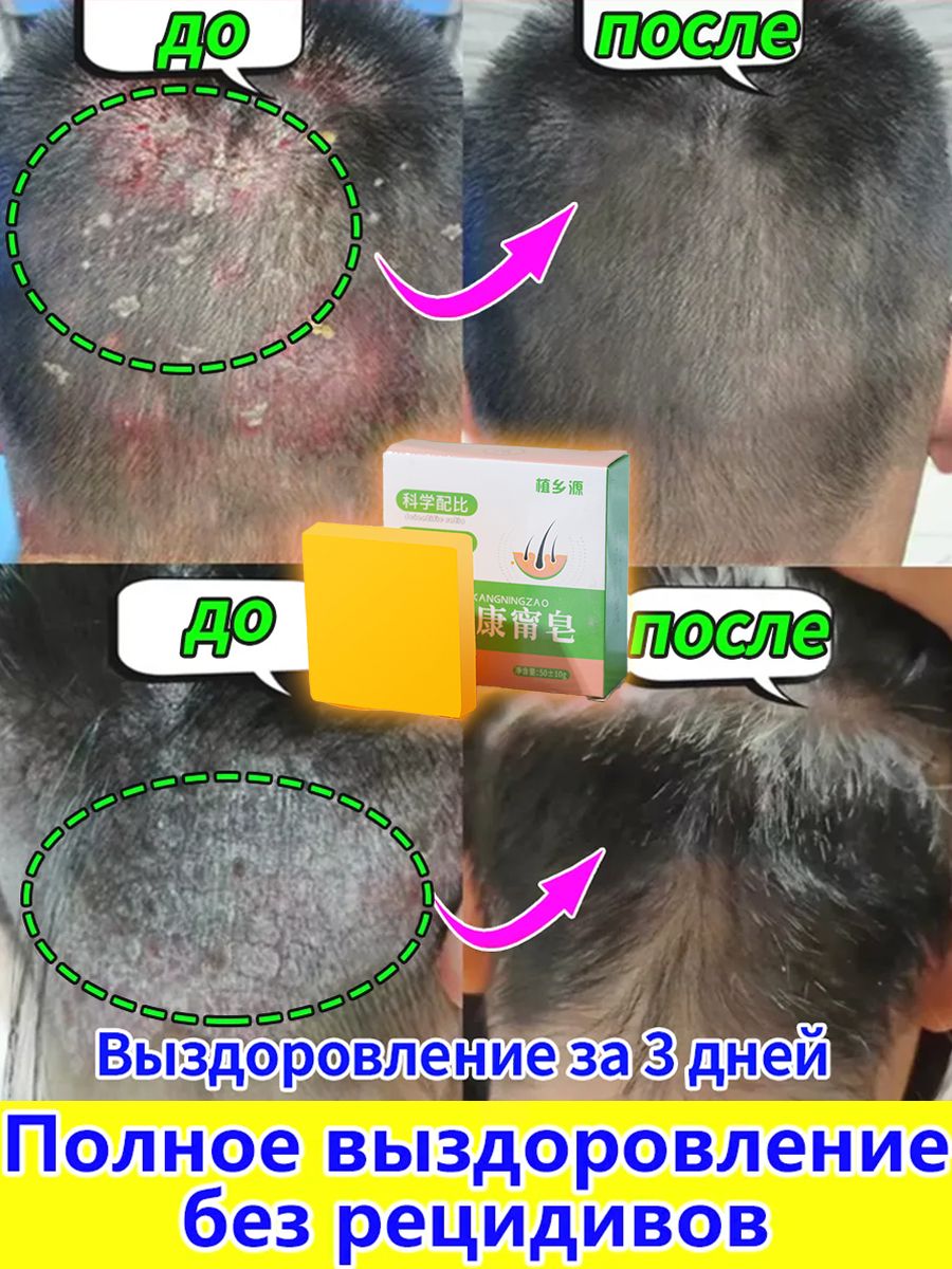 Твердое мыло