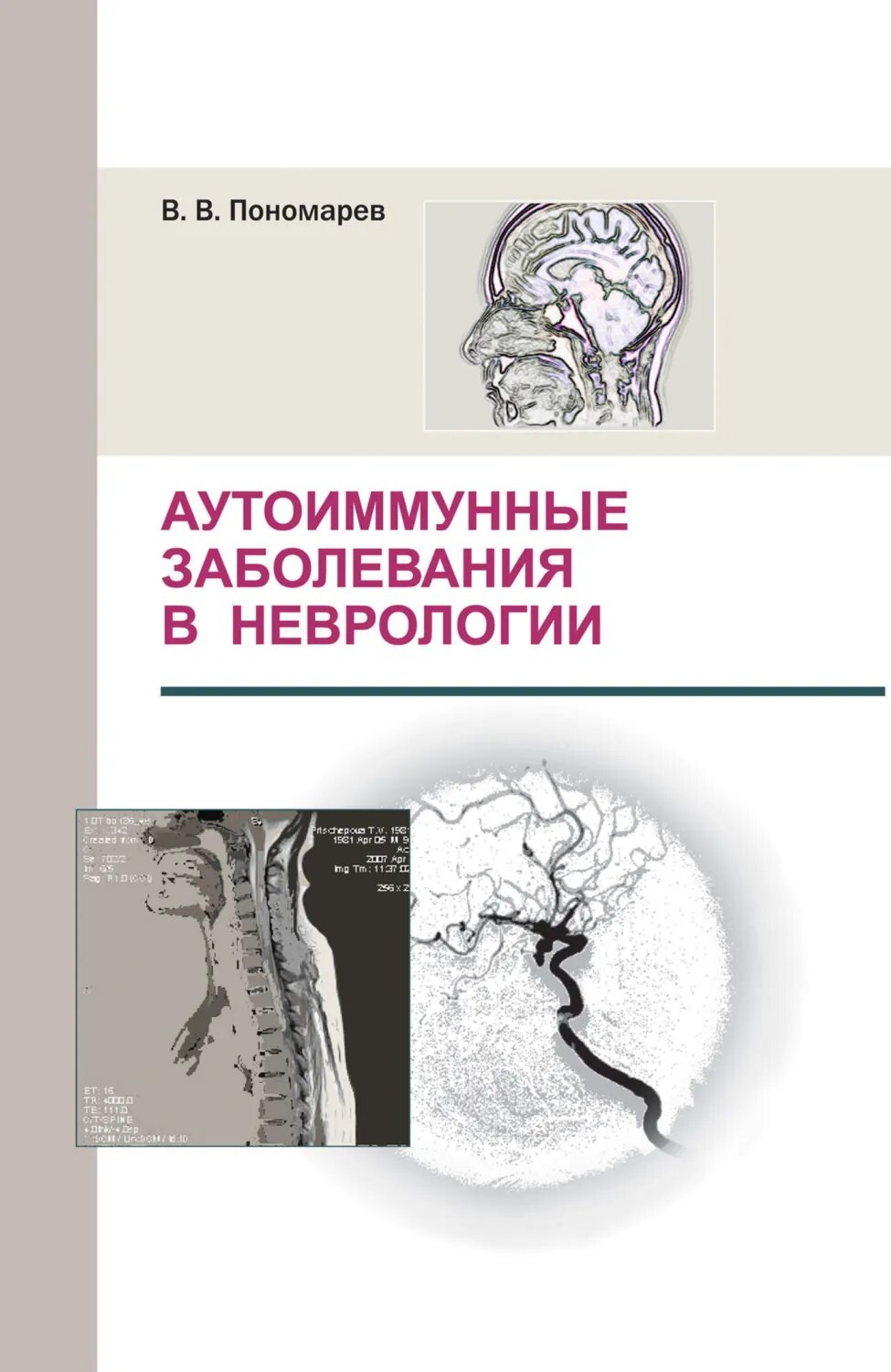 Аутоиммунные заболевания в неврологии [Цифровая книга]