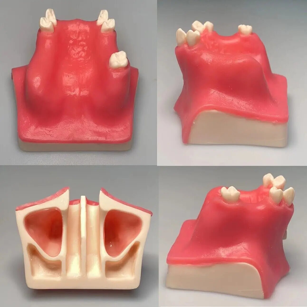 Анатомическая модель синус-лифтинга C001 Resin
