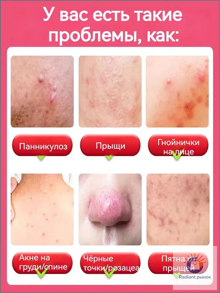 Твердое мыло — фото 1