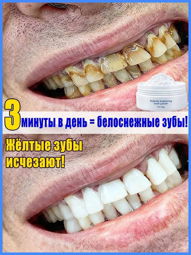 Порошок для отбеливания зубов профессиональный, Удаляет зубной камень и налет, неприятного запаха изо рта, для чувствительных зубов, улучшает здоровье полости рта, 50 г