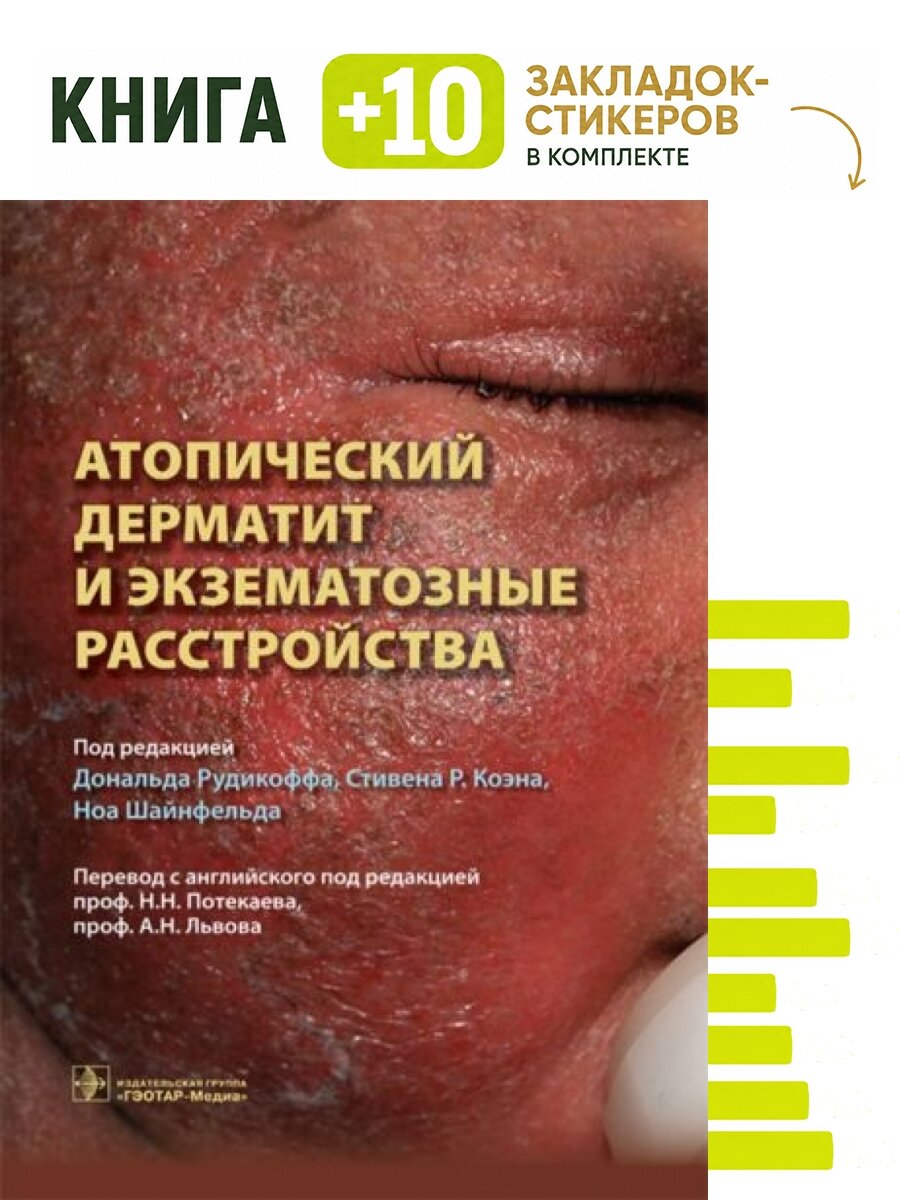 Атопический дерматит и экзематозные расстройства. Комплект: книга + 10 закладок-стикеров