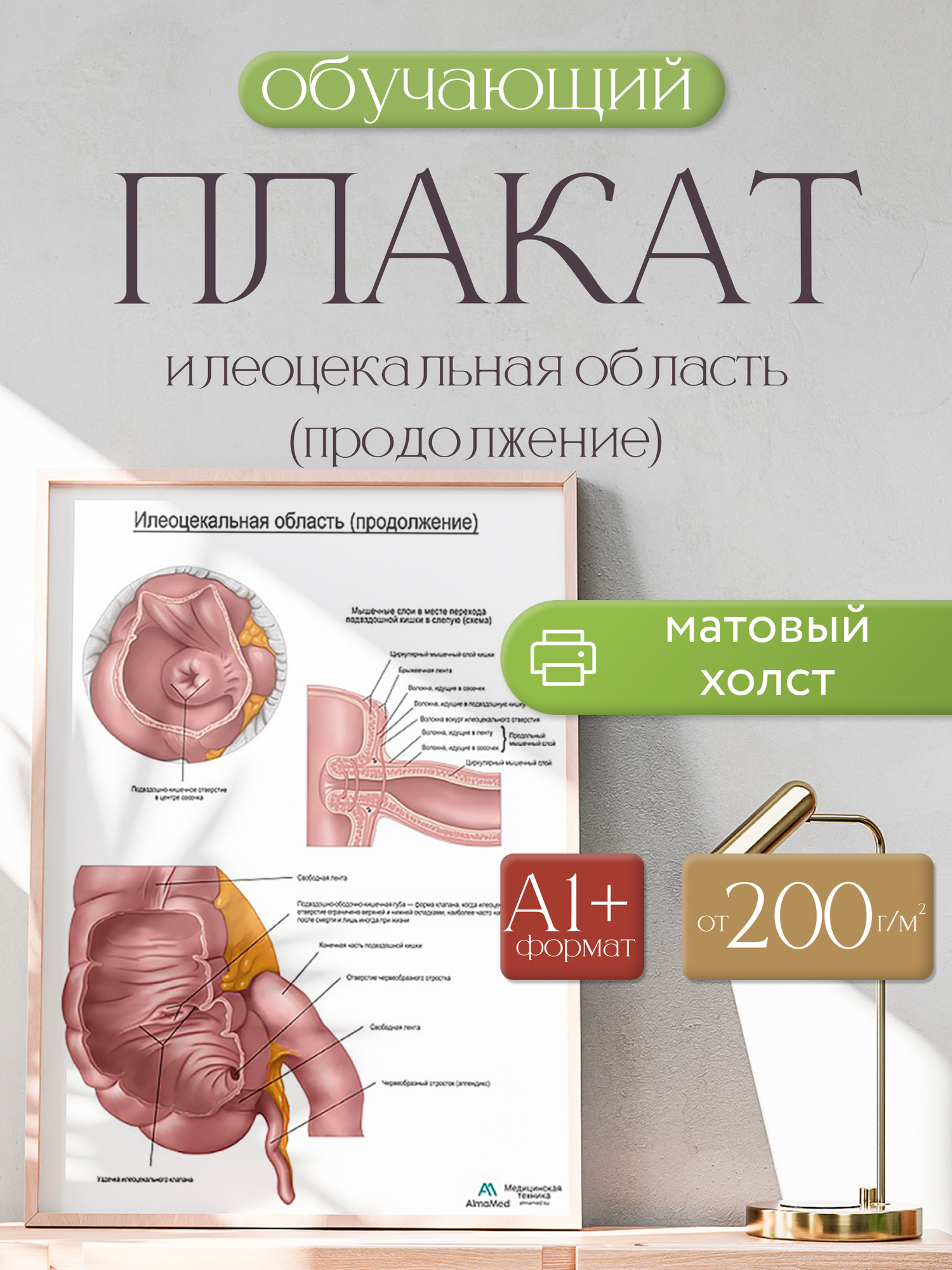 Обучающий плакат "Подвздошно-слепокишечная область, продолжение", размер А1+, матовый холст от 200г/м2