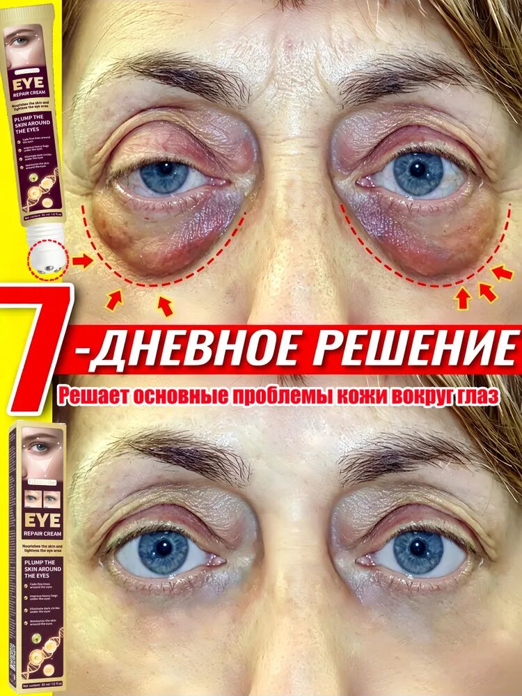 Роллер-крем для кожи вокруг глаз 300 мл, лифтинг, убирает отёки, темные круги и мешки под глазами, разглаживает мелкие морщины, антивозрастной уход за кожей