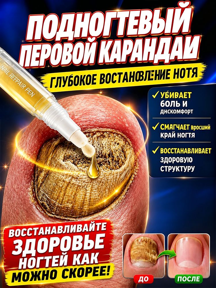 Карандаш для ухода за ногтями от онихомикоза, паронихии и ороговидении, облегчает зуд, покраснение и отек, корректирует
