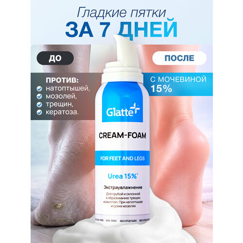Крем для ног Glatte от трещин и натоптышей с мочевиной 10%