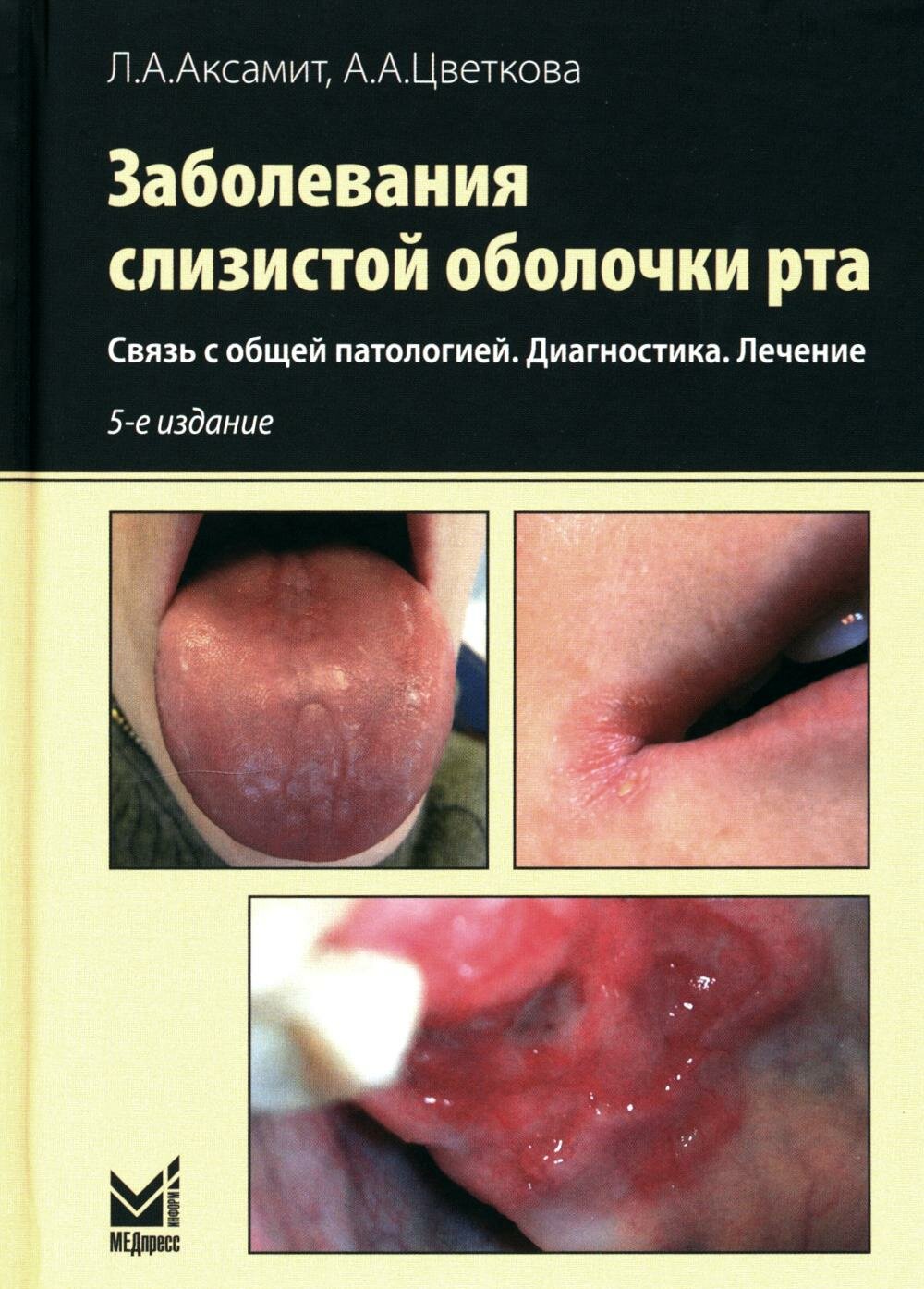 Заболевания слизистой оболочки рта. Связь с общей патологией. Диагностика. Лечение