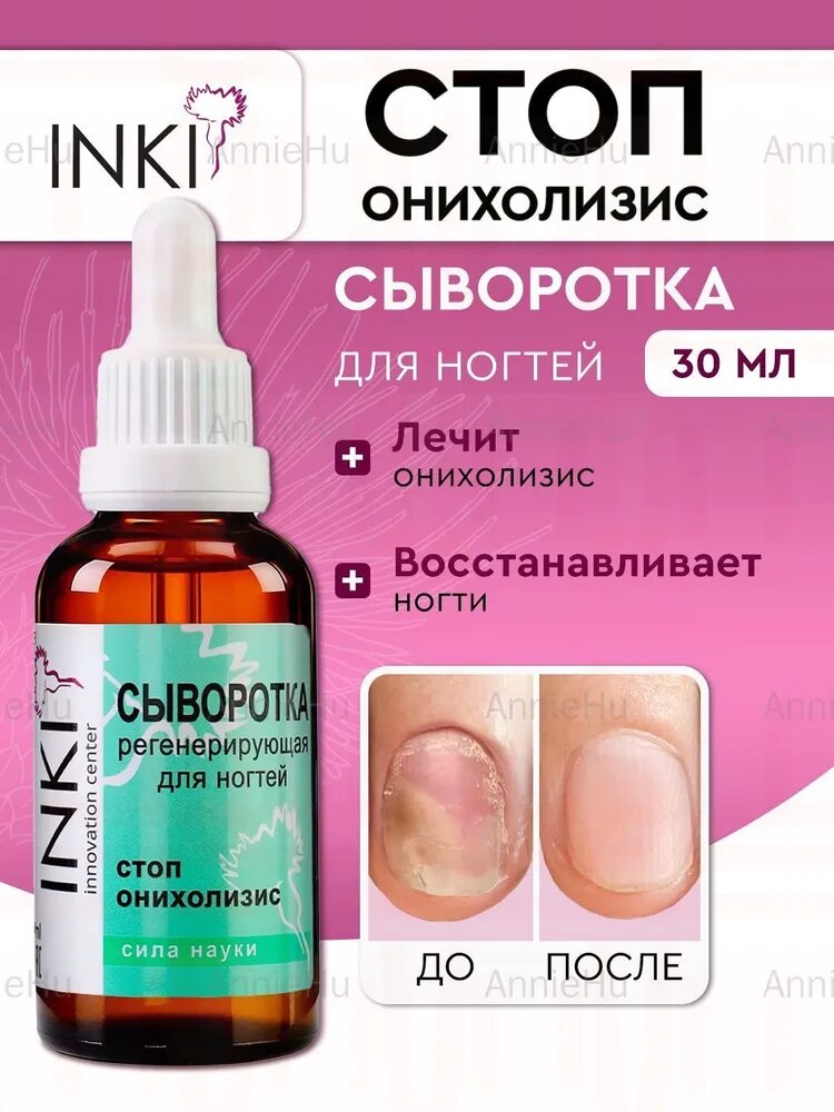 Сыворотка стоп онихолизис средство для лечения ногтей 30 мл