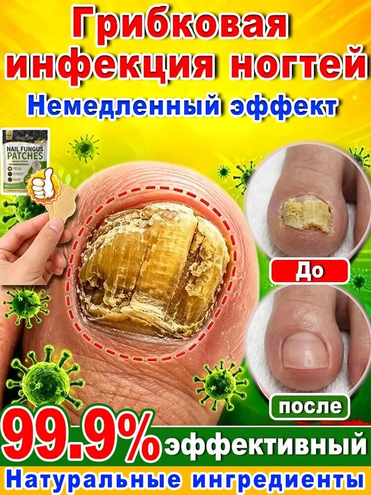 21 штука антибактериальных наклеек от грибка ногтей, быстро впитываются, восстанавливают ногти, водонепроницаемы, подходят для обесцвечивания, утолщения, растрескивания и боли при грибке ногтей