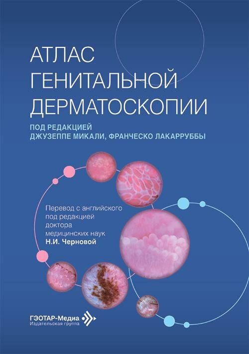 Атлас генитальной дерматоскопии / под ред. Джузеппе Микали, Франческо Лакарруббы ; пер. с англ. под
