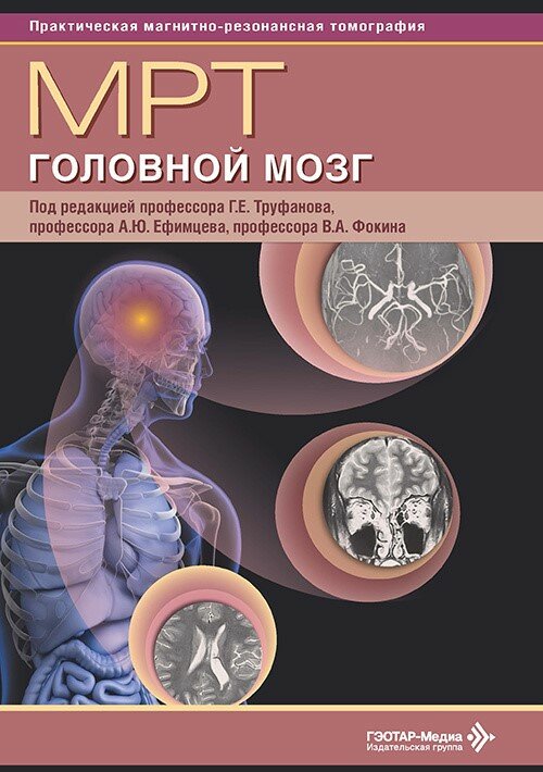 МРТ. Головной мозг : руководство для врачей / под ред. Г. Е. Труфанова, А. Ю. Ефимцева, В. А. Фокина