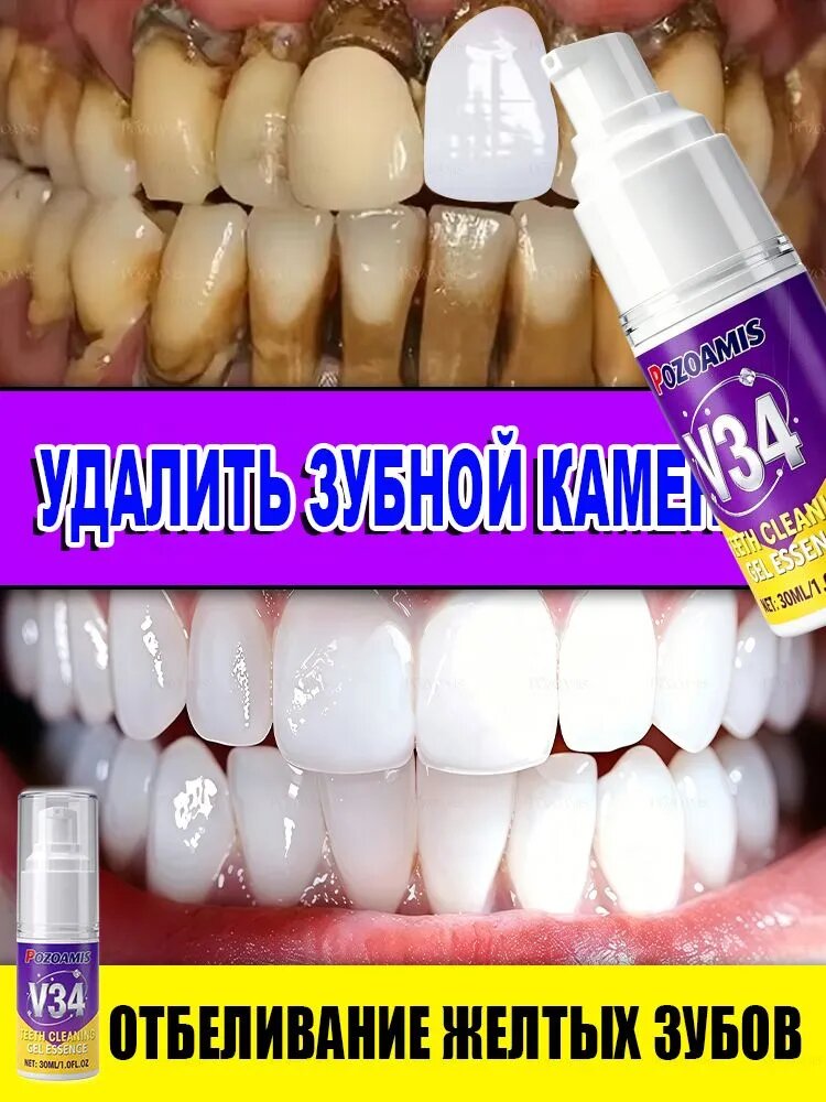 Эта фиолетовая зубная паста отбеливает, глубоко очищает, уменьшает пятна, защищает десны и устраняет неприятный запах изо рта. 30 мл
