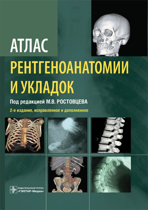 Атлас рентгеноанатомии и укладок. Ростовцев.