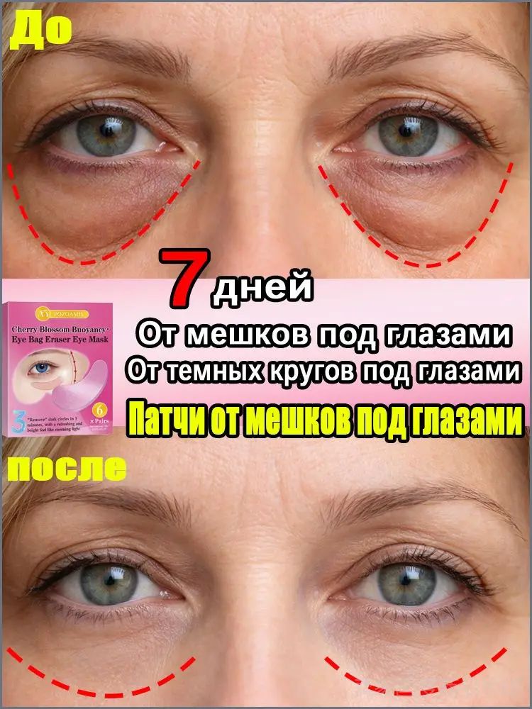 Лифтинг патчи для глаз, от морщин и отеков, с коллагеном, сияние и восстановление, 18 пар