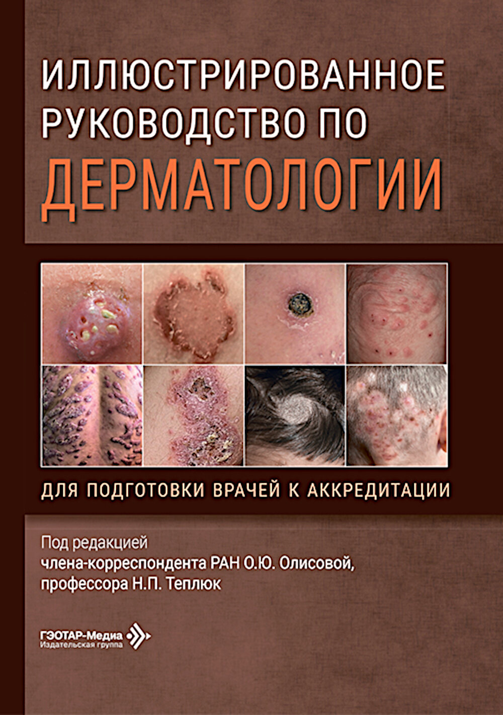 Иллюстрированное руководство по дерматологии. Для подготовки врачей к аккредитации / под ред. О. Ю. Олисовой, Н. П. Теплюк. — Москва : гэотар-медиа, 2. Под ред. Олисовой О. Ю, Теплюк Н. П.