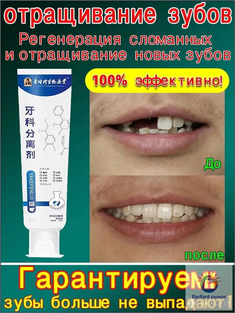 Лечебная зубная паста: регенерация и отращивание зубов, восстановление сломанных, ремонт эмали, укрепление десен, защита от выпадения