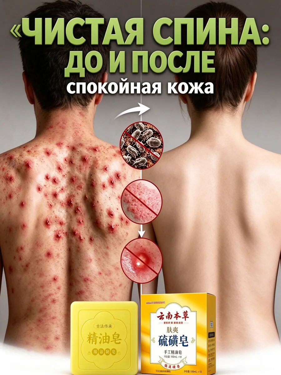 Мыло серное деликатное 100г