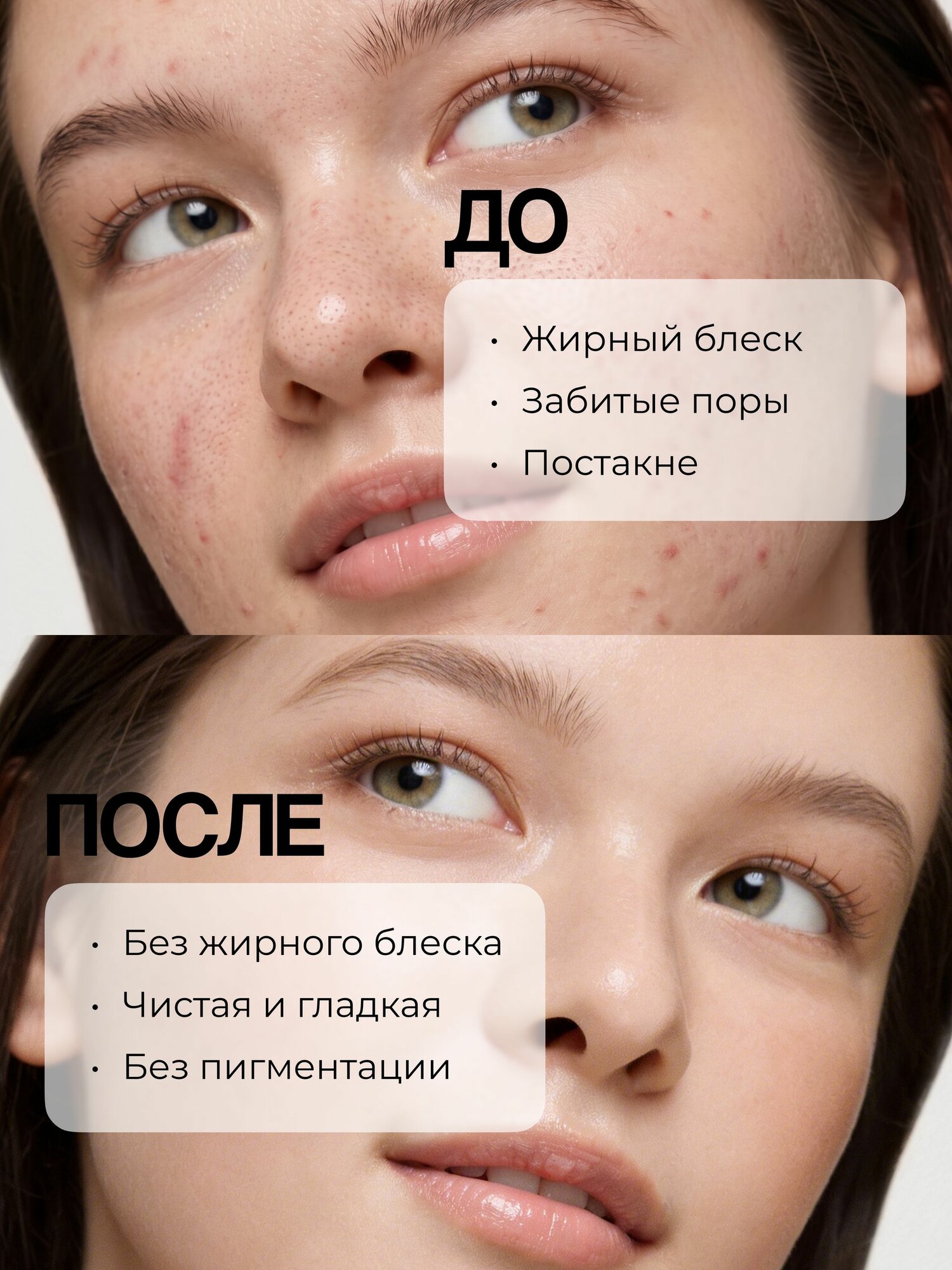 SOME BY MI 30 DAYS MIRACLE AC SOS KIT - Косметический дорожный набор для ухода за лицом: тонер, сыворотка, крем для лица, пенка
