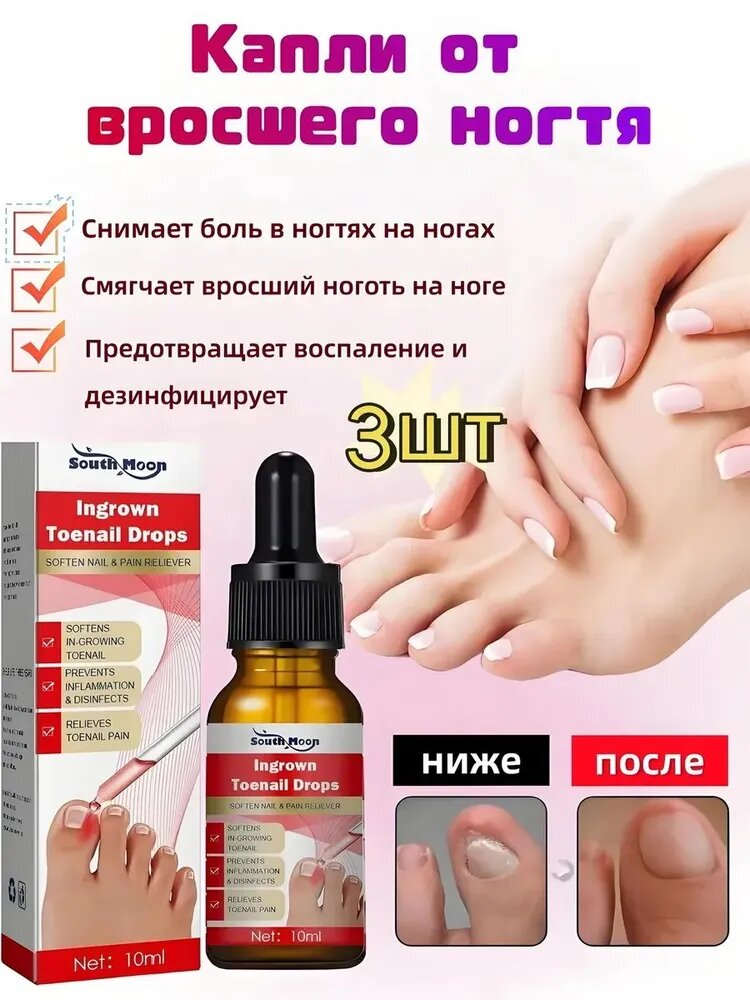 Лосьон голден трейс для вросших ногтей