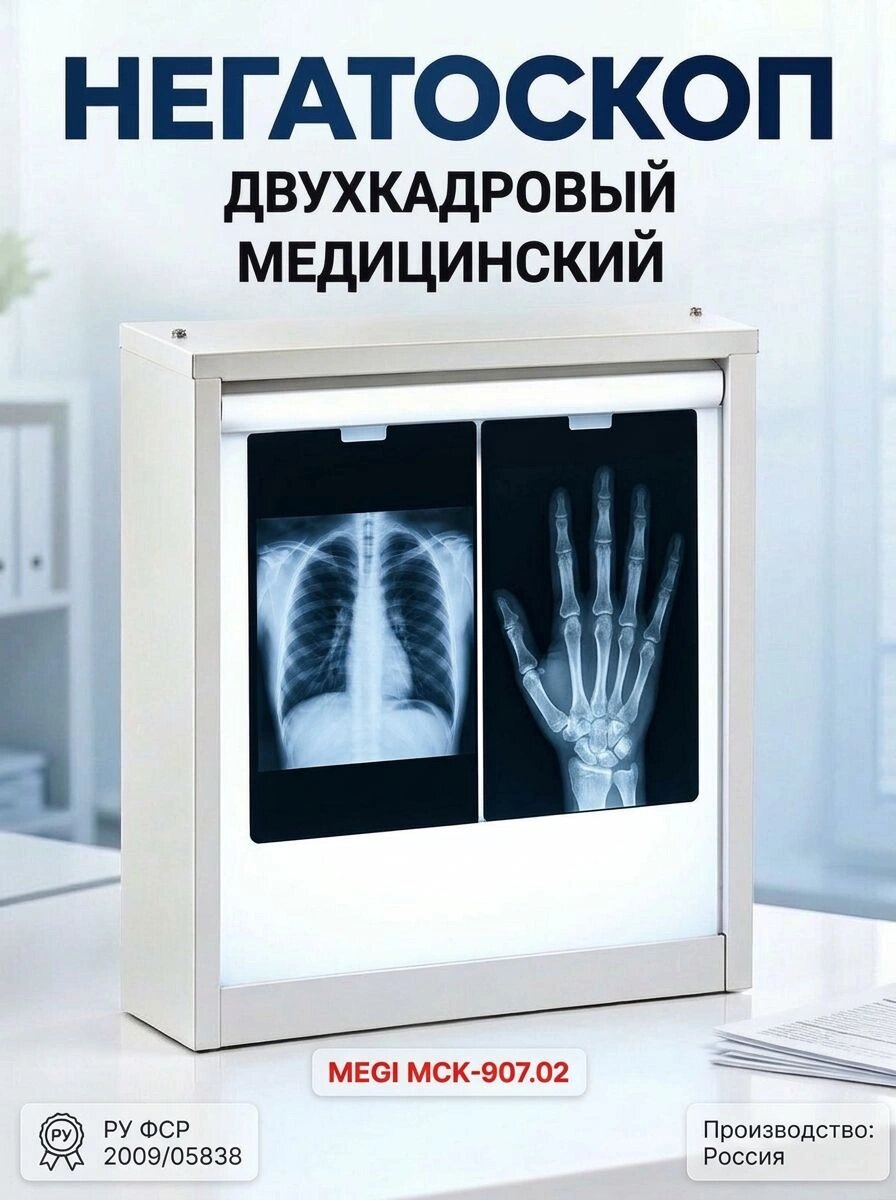 Негатоскоп люминесцентный общего назначения медицинский меги МСК-907.02 двухкадровый, 4 лампы по 18 Вт.