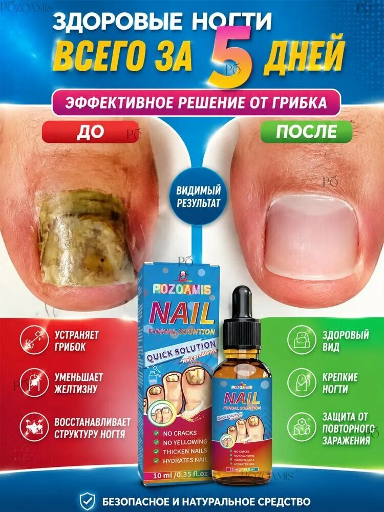 Эфирные масла от грибка ногтей - это средство от грибка ногтей, которое легко переносится и имеет легкий флакон объемом 10 мл.1бутылка.