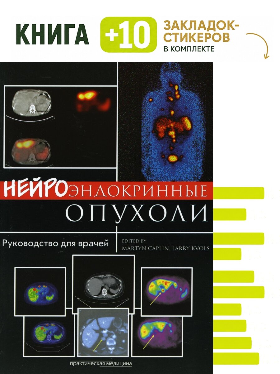 Нейроэндокринные опухоли. Комплект: книга + 10 закладок-стикеров