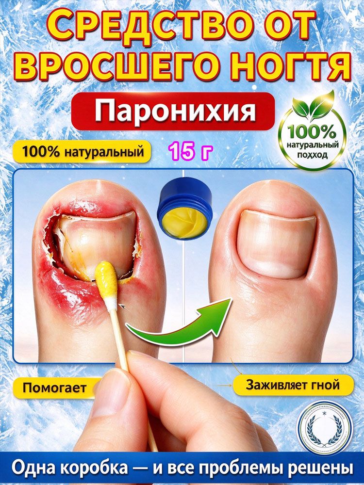 Ногтей и кутикулы от вросшего ногтя на ногах: размягчитель ногтевой пластины от воспалений и паронихии