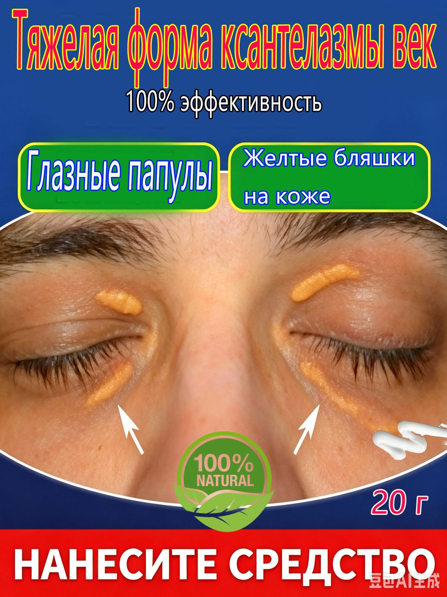 Мазь для рассасывания ксантелазмы век