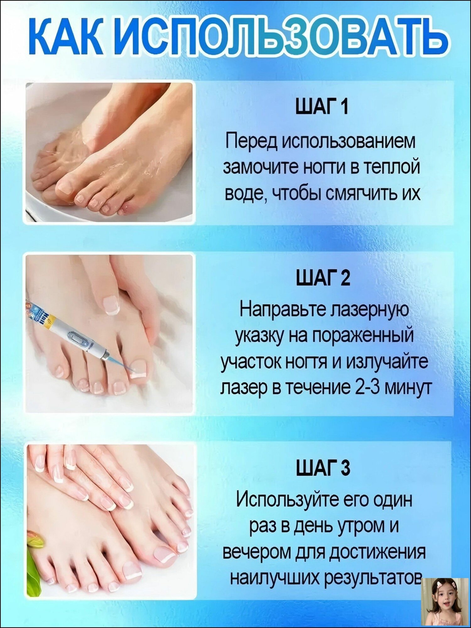 Лазерная ручка для лечения онихомикоза может устранить стойкий онихомикоз за 7 дней, улучшить состояние при паронихии, а также вылечить утолщение ногтей, покраснение, отек, зуд, расслоение и т. д.
