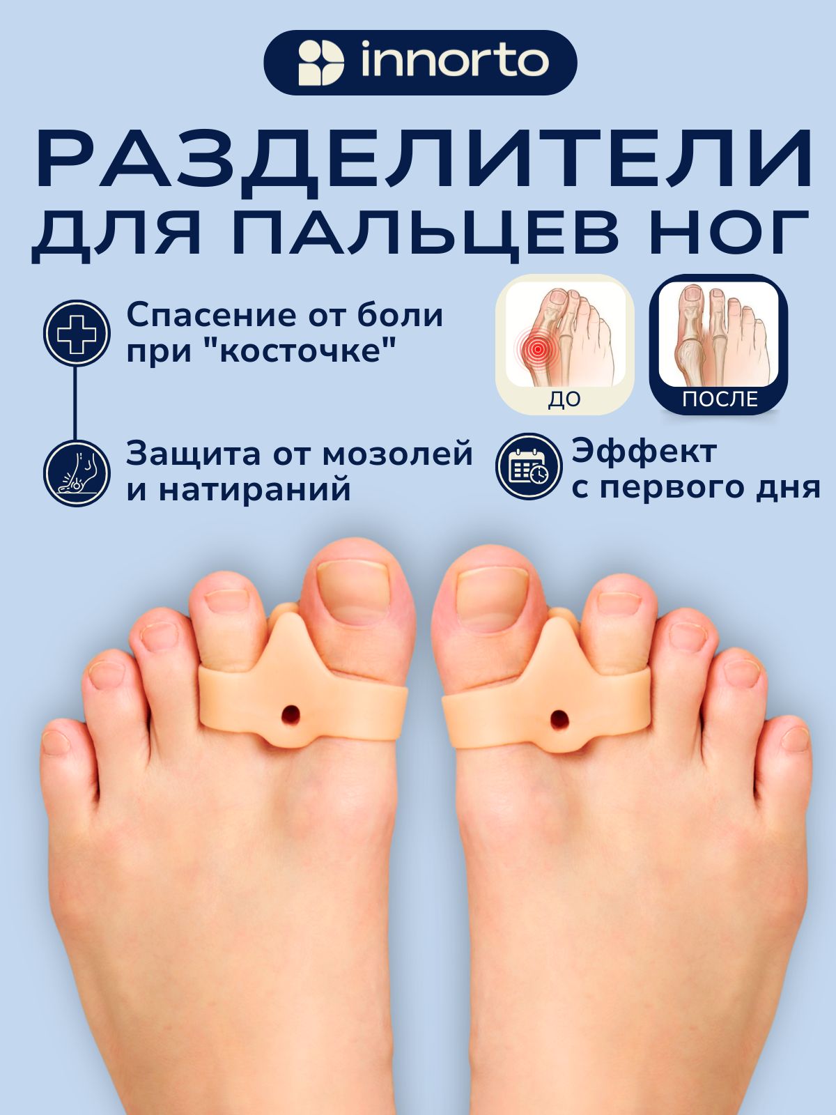INNORTO Разделитель для пальцев ног ортопедические, 2 шт