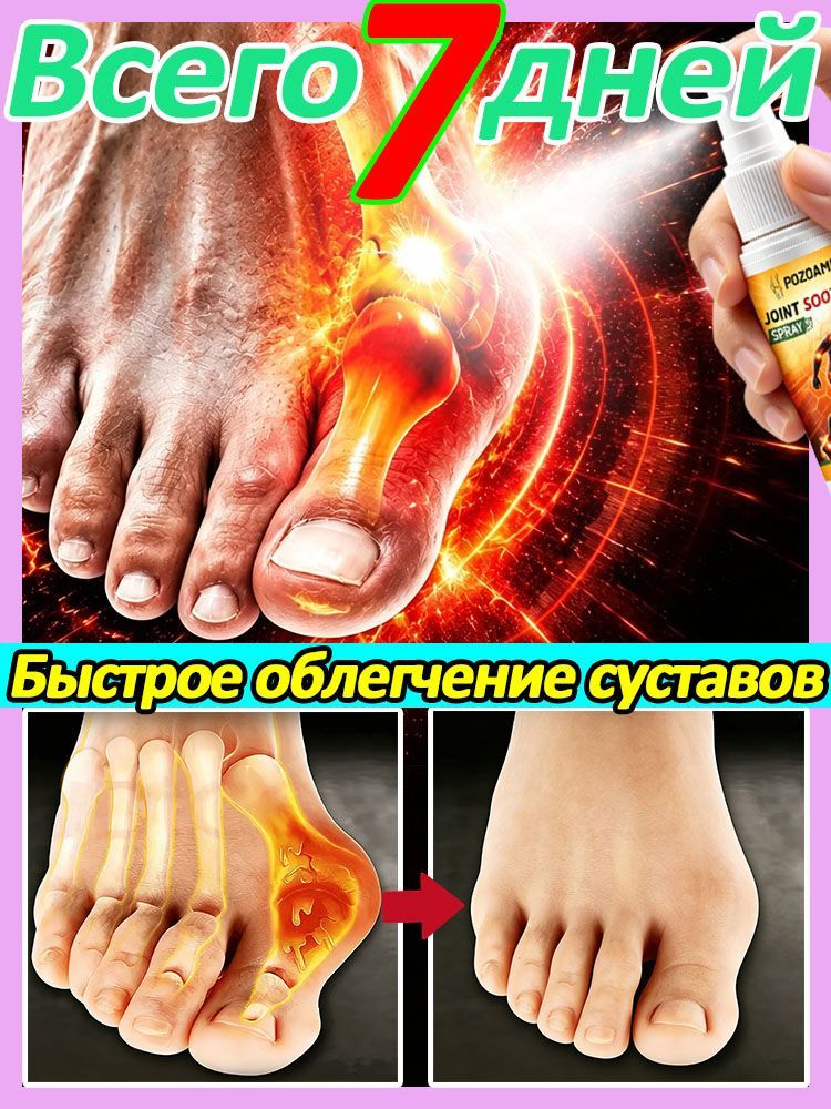 Обезболивающий охлаждающий спрей для суставов натуральный китайский состав, от болей в спине, колен, при артрите и растяжениях, успокаивает и убирает отеки 30 мл