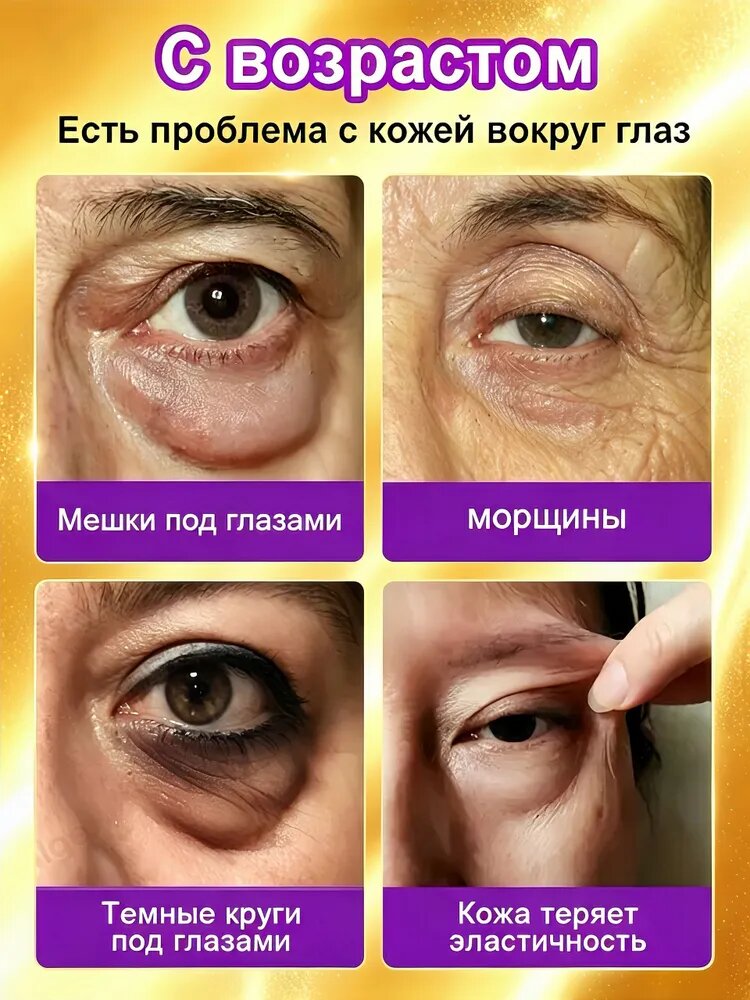 Роллер-крем для кожи вокруг глаз 90 мл, лифтинг, убирает отёки, темные круги и мешки под глазами, разглаживает мелкие морщины, антивозрастной уход за кожей