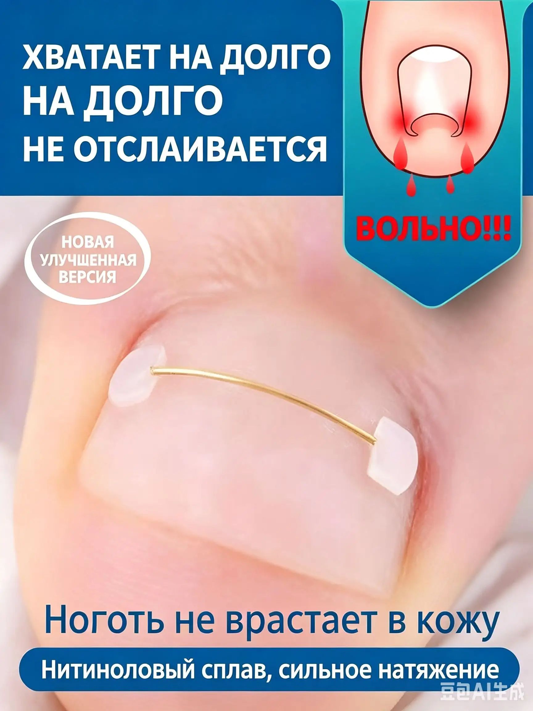Корректор вросшего ногтя на ноге с никель-титановой проволокой избавляет от боли