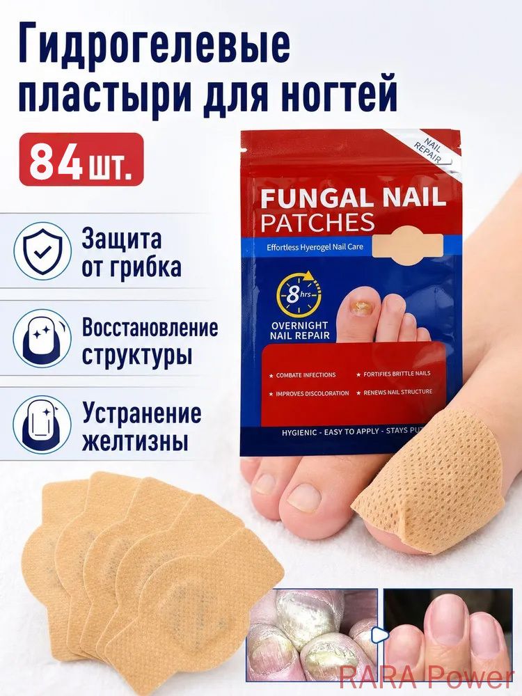 Пластыри для лечения онихомикоза, Грибковые поражения ногтей, 84 шт.