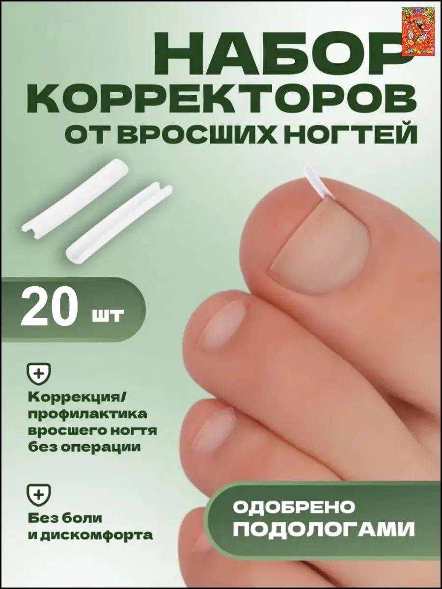 Корректор От Вросших Ногтей На Ногах