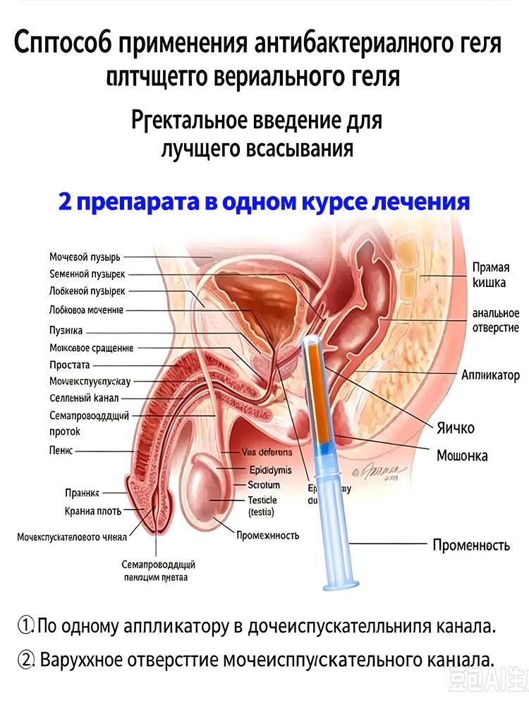 Гель для простаты,2шт, используемый при простатите, болезненное, затрудненное мочеиспускание, частое мочеиспускание