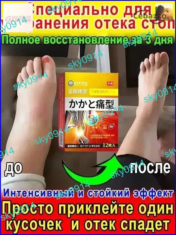 Патчи для ног от отеков тяжести и давления 12 шт - снятие усталости и улучшение кровообращения