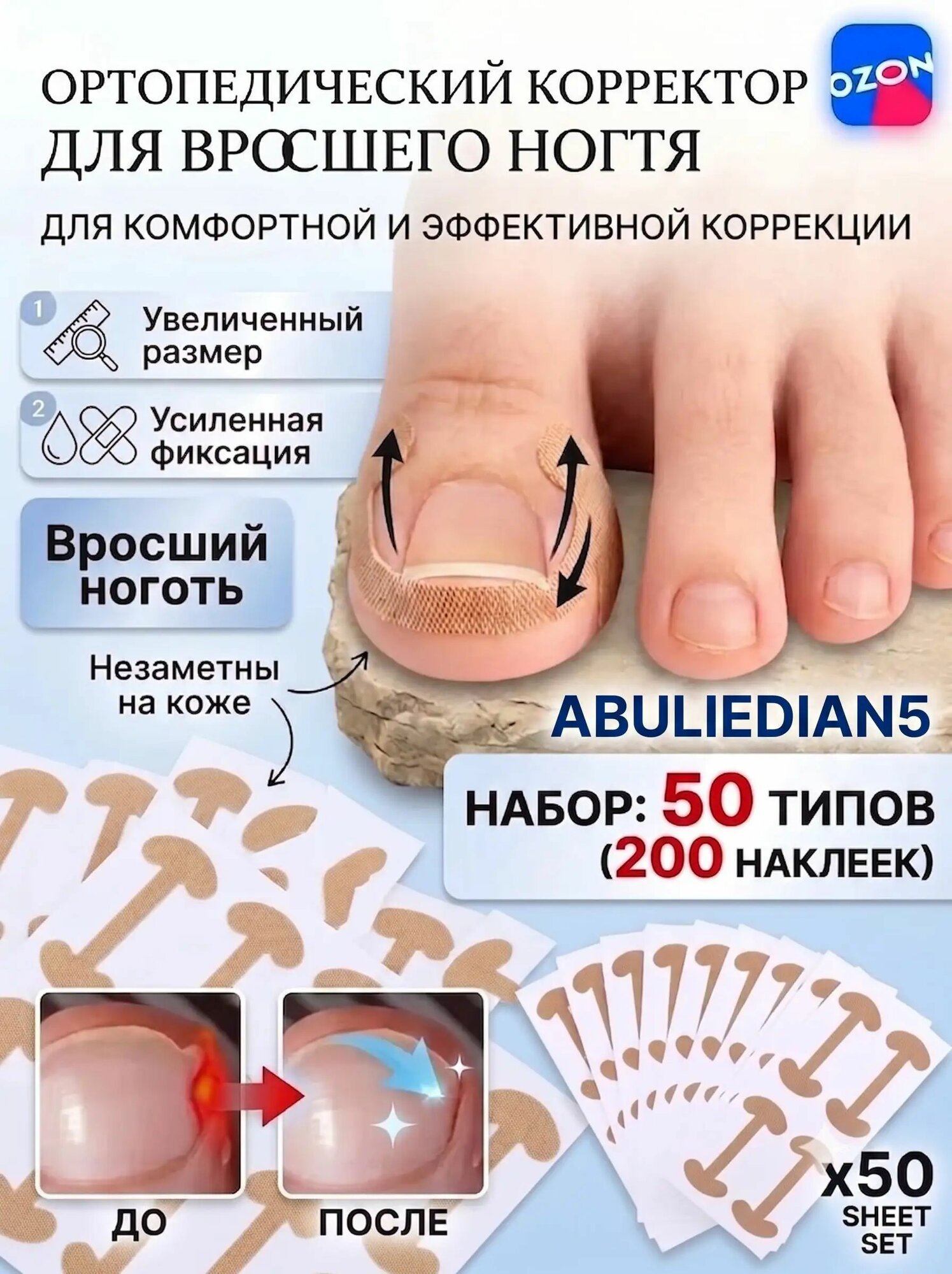 Ортопедический корректор для вросшего ногтя, патчи-наклейки от врастания ногтей, 50 листов (200 шт)