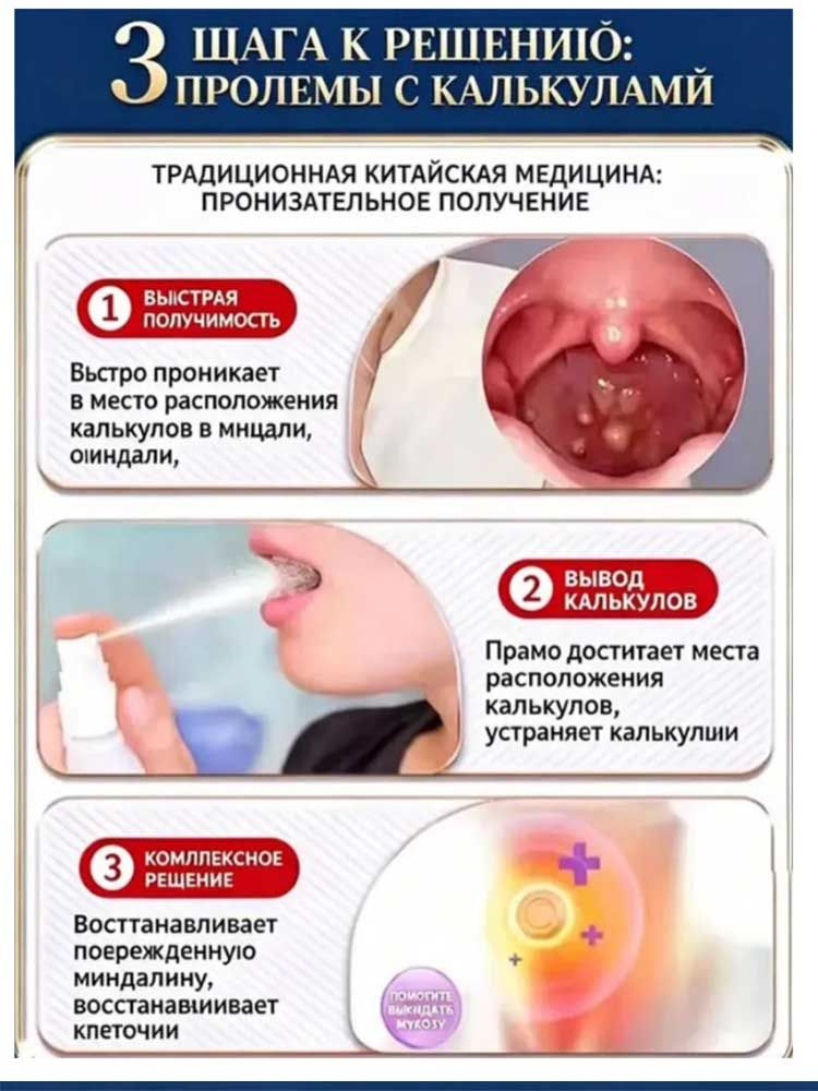 Спрей для горла//ангина, тонзилит, фарингит, ларингит, Кашель от посторонних предметов, сухой и зудящий 30 мл